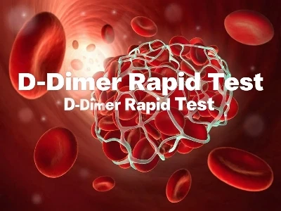Mengapa menguji d - dimer? Apa keuntungan dari d - uji cepat d dimer?